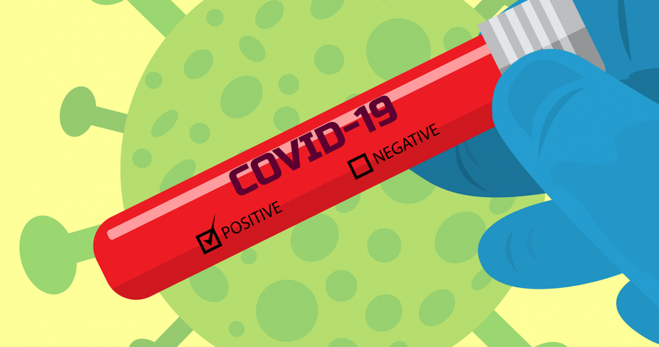 Antigen Test